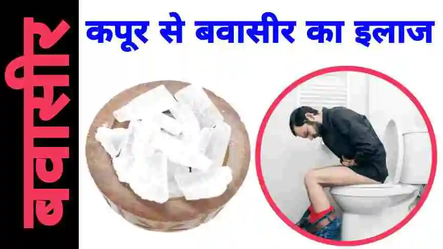 कपूर से बवासीर का इलाज