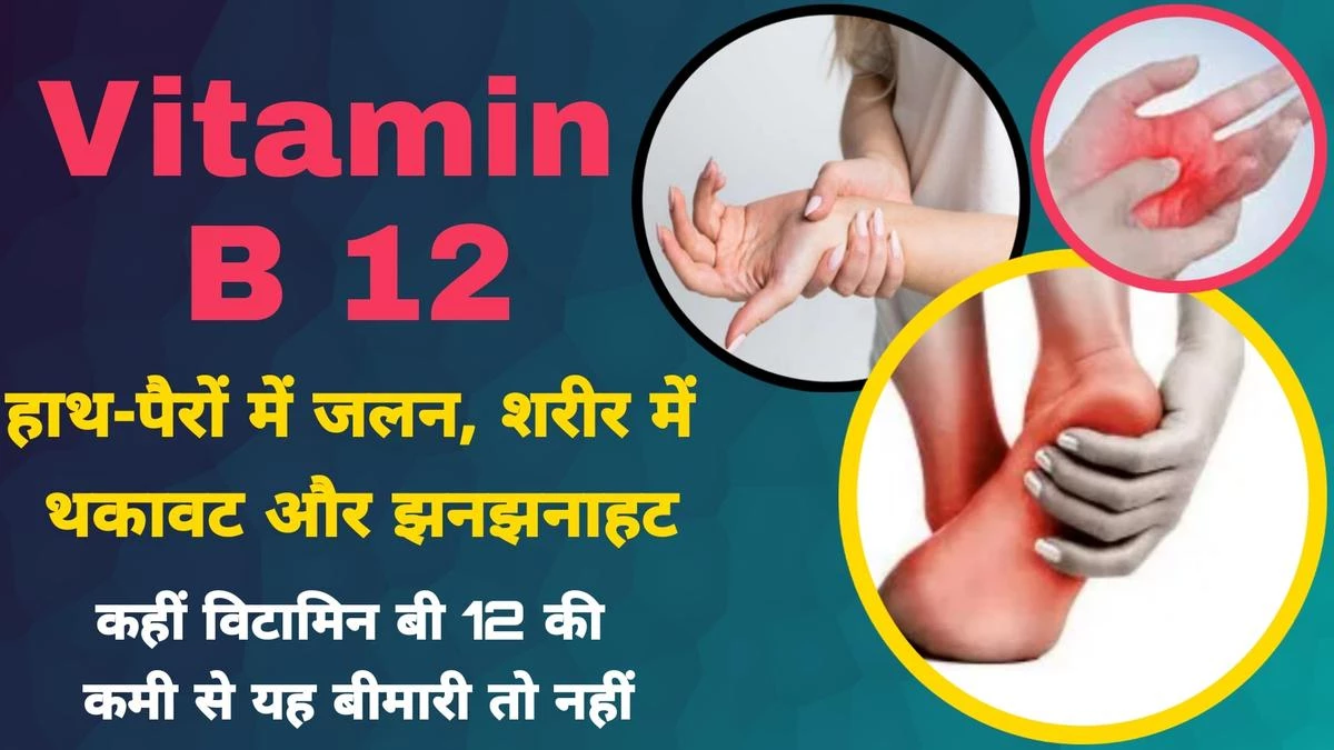 Vitamin B 12: हाथ-पैरों में जलन, शरीर में थकावट और झनझनाहट? कहीं विटामिन बी 12 की कमी से यह बीमारी तो नहीं